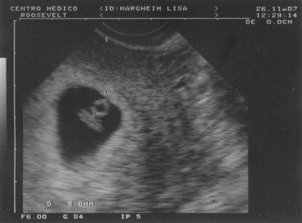 Steve and I are happy to announce that I'm 10 weeks pregnant.